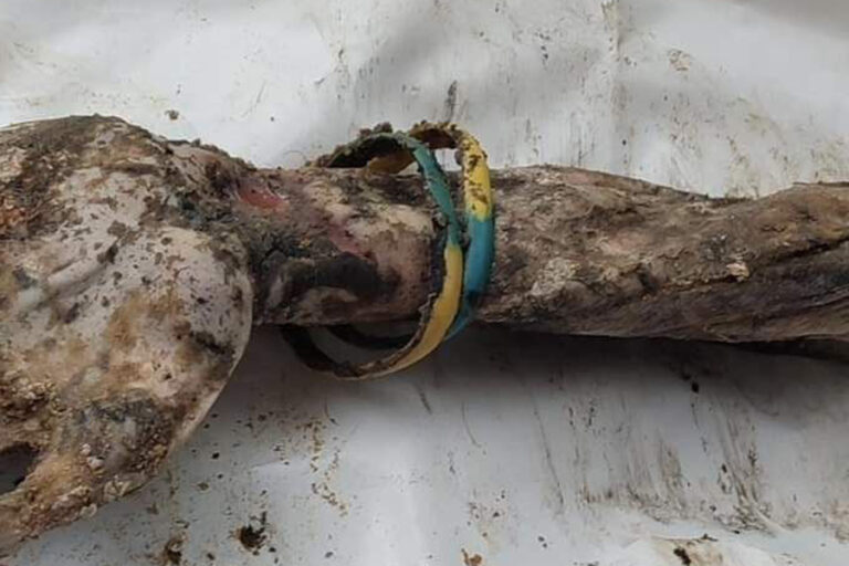 Armbänder an der Hand von Serhij Sowa nach der Exhumierung. Foto aus offenen Quellen.