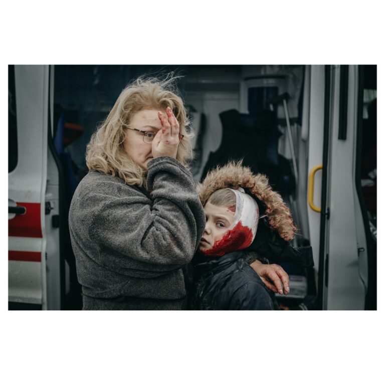 Жінка обіймає сина, який отримав поранення під час російського обстрілу. Фото: Wojciech Grzedzinski для The Washington Post